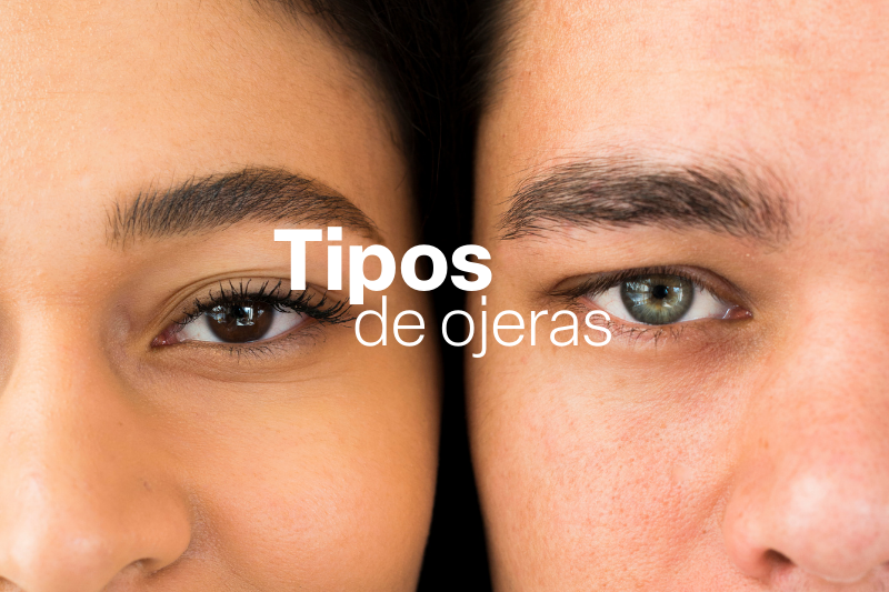 copia de tipos (800 x 533 px)